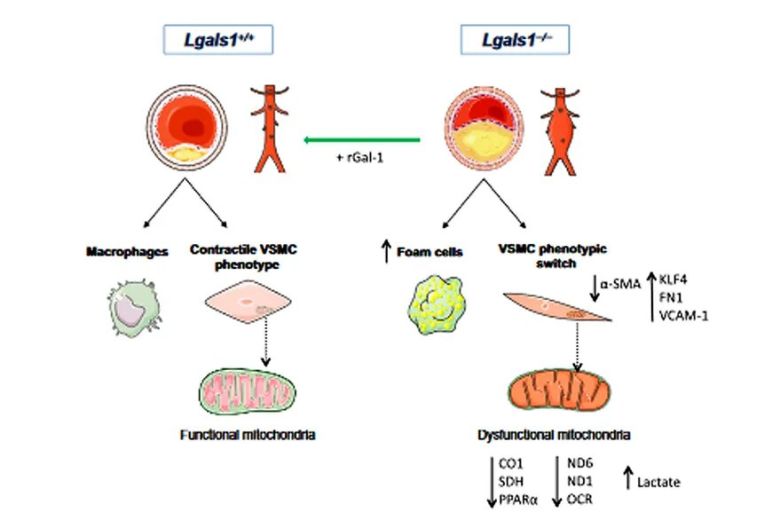 Publicado en Science Advances: descubren el rol clave de la galectina-1, una proteína que podría prevenir la aterosclerosis