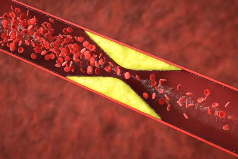 Publicado en Science Advances: descubren el rol clave de la galectina-1, una proteína que podría prevenir la aterosclerosis