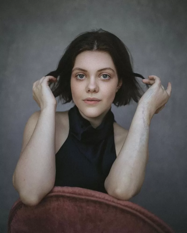 Georgie Henley, actriz de "Las Crónicas de Narnia", revela que sufrió fascitis necrosante y muestra por primera vez sus cicatrices